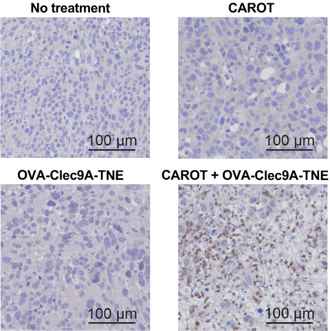 Enhancing chimeric antigen receptor T-cell immunotherapy against cancer using a nanoemulsion-based vaccine targeting cross-presenting dendritic cells