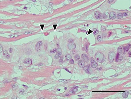 Details are in the caption following the image