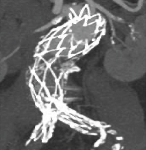 Details are in the caption following the image