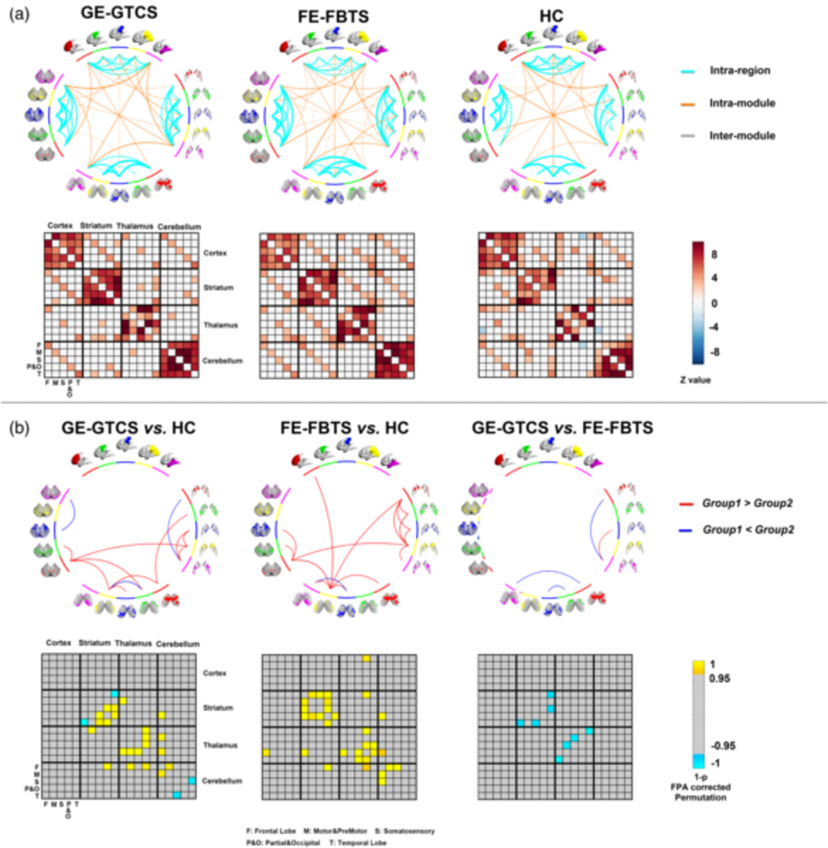 Cortico-striato-thalamo-cerebellar networks of structural covariance underlying different epilepsy syndromes associated with generalized tonic–clonic seizures