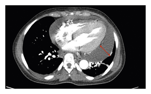 Details are in the caption following the image Details are in the caption following the image