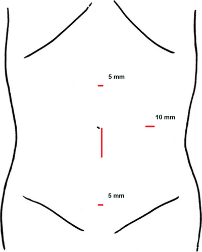 Details are in the caption following the image Details are in the caption following the image