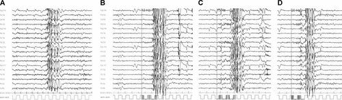 Details are in the caption following the image Details are in the caption following the image