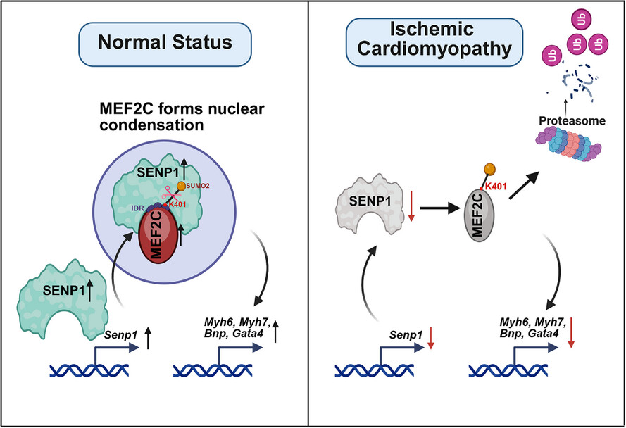 Downregulation of SENP1 impairs nuclear condensation of MEF2C and deteriorates ischemic cardiomyopathy