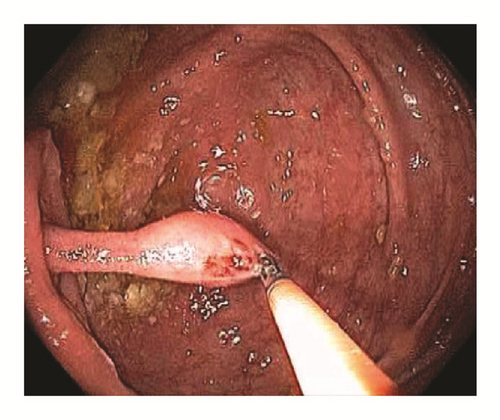 Details are in the caption following the image Details are in the caption following the image