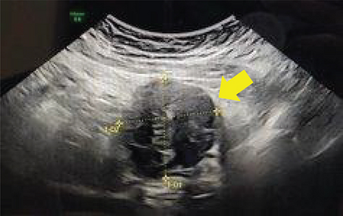 Details are in the caption following the image Details are in the caption following the image