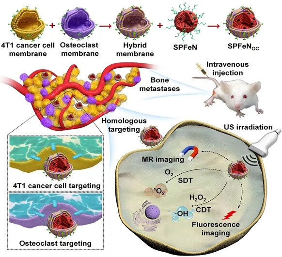 Dual-Targeting Biomimetic Semiconducting Polymer Nanocomposites for Amplified Theranostics of Bone Metastasis