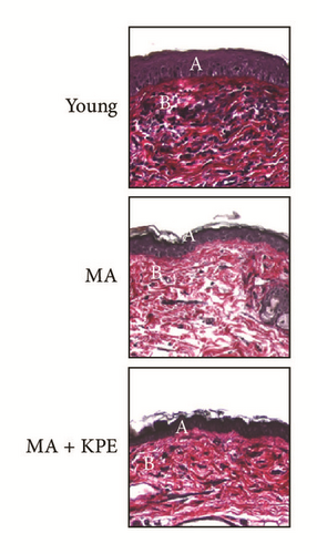 Details are in the caption following the image