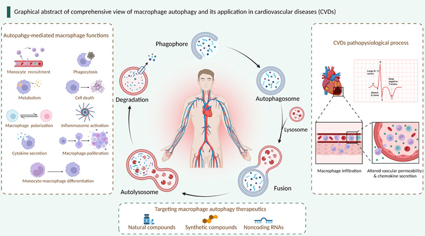 Comprehensive view of macrophage autophagy and its application in cardiovascular diseases