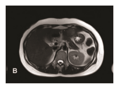 Details are in the caption following the image