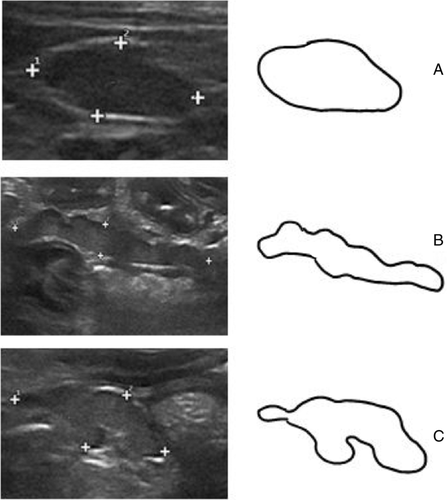 Details are in the caption following the image Details are in the caption following the image