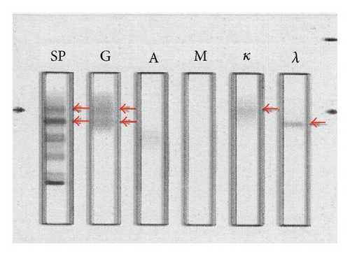 Details are in the caption following the image