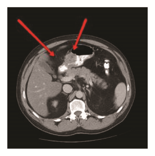 Details are in the caption following the image Details are in the caption following the image
