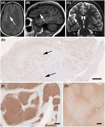 Details are in the caption following the image Details are in the caption following the image