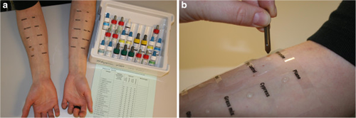 Details are in the caption following the image Details are in the caption following the image