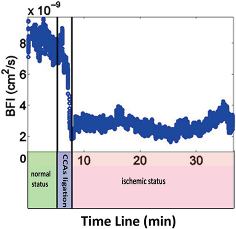 Diffuse optical detection of global cerebral ischemia in an adult porcine model
