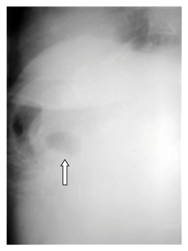 Details are in the caption following the image