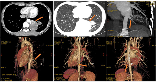 Details are in the caption following the image Details are in the caption following the image