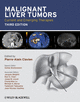 Malignant Liver Tumors cover image