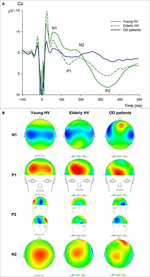 Spatiotemporal characteristics of the pharyngeal event-related potential in healthy subjects and older patients with oropharyngeal dysfunction