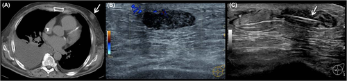 Details are in the caption following the image Details are in the caption following the image
