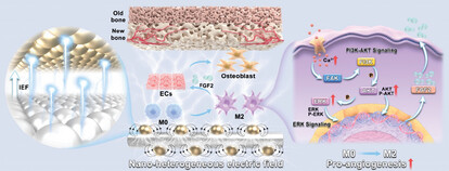 Remodel Heterogeneous Electrical Microenvironment at Nano-Scale Interface Optimizes Osteogenesis by Coupling of Immunomodulation and Angiogenesis