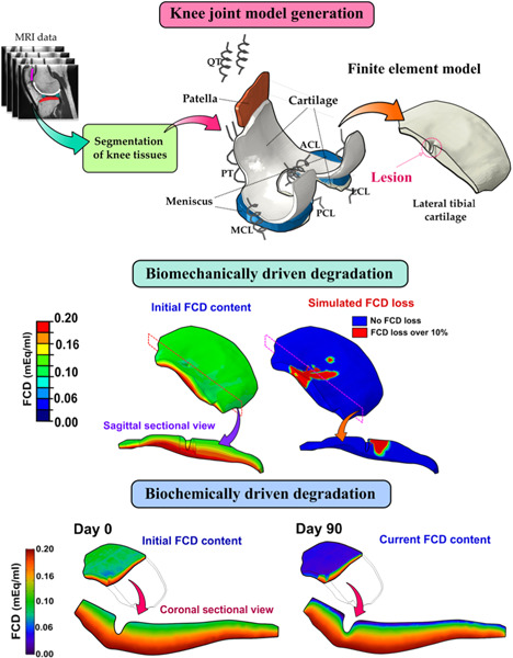 Shear strain and inflammation-induced fixed charge density loss in the knee joint cartilage following ACL injury and reconstruction: A computational study
