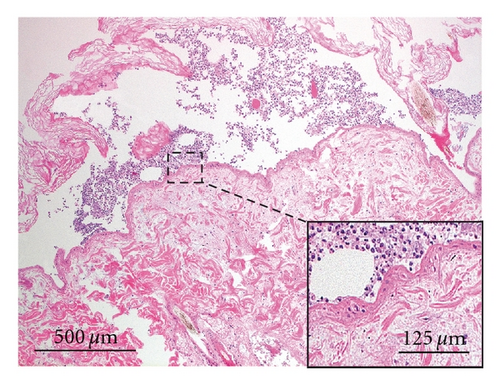 Details are in the caption following the image