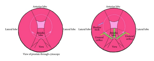Details are in the caption following the image