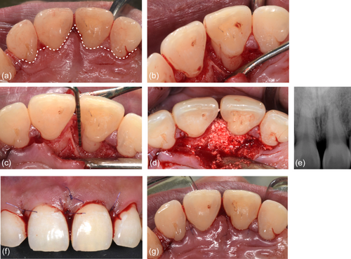 Details are in the caption following the image Details are in the caption following the image
