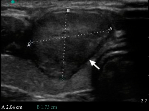 Details are in the caption following the image