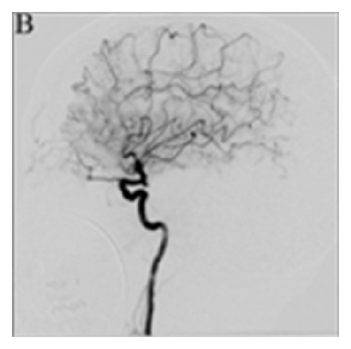 Details are in the caption following the image