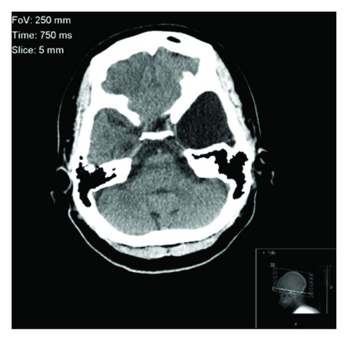 Details are in the caption following the image Details are in the caption following the image