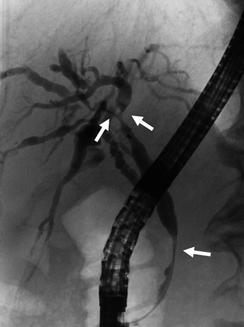 Clinical practice guidelines for IgG4-related sclerosing cholangitis