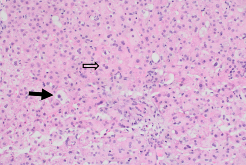 Details are in the caption following the image