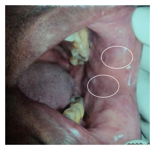 Details are in the caption following the image Details are in the caption following the image