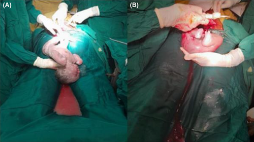 Details are in the caption following the image Details are in the caption following the image