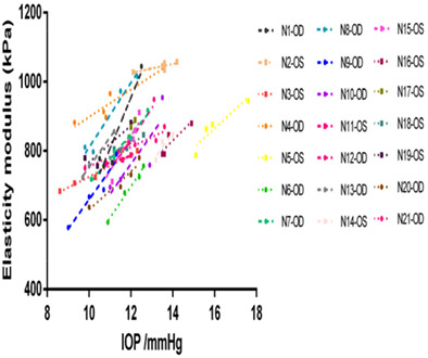 Diurnal variation of corneal elasticity in healthy young human using air-puff optical coherence elastography