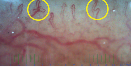 Details are in the caption following the image Details are in the caption following the image
