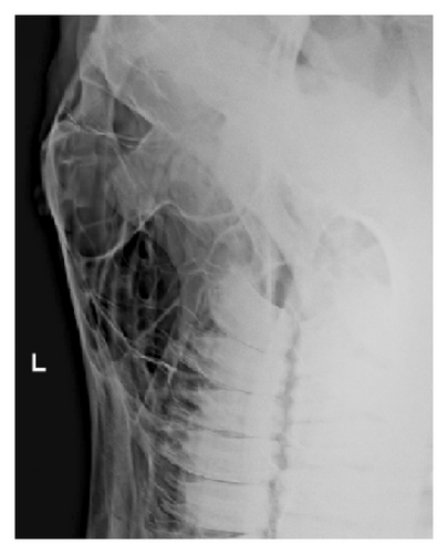 Details are in the caption following the image