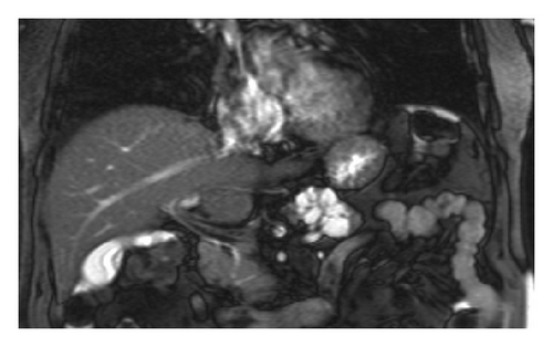 Details are in the caption following the image
