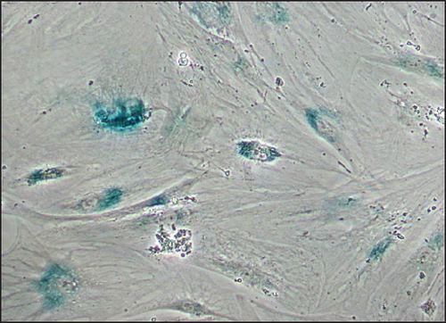 Details are in the caption following the image