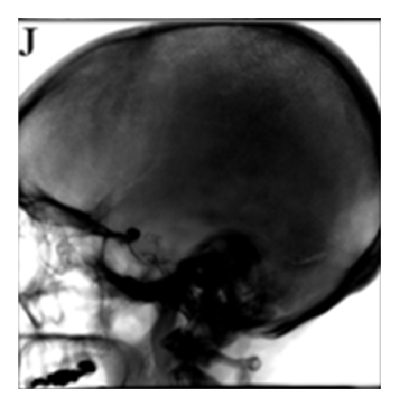 Details are in the caption following the image