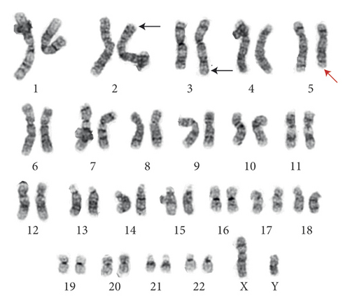 Details are in the caption following the image