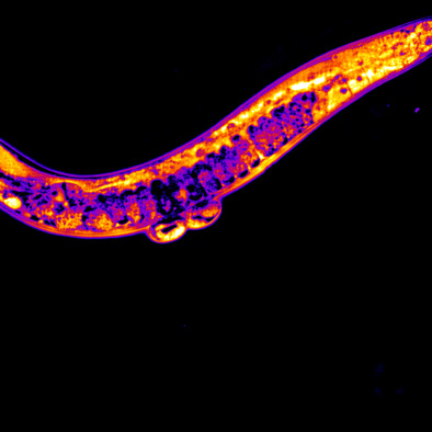 Single-shot phase contrast microscopy using polarisation-resolved differential phase contrast