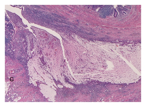 Details are in the caption following the image