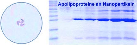 Detailed Identification of Plasma Proteins Adsorbed on Copolymer Nanoparticles