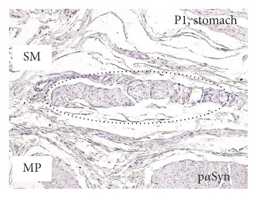 Details are in the caption following the image