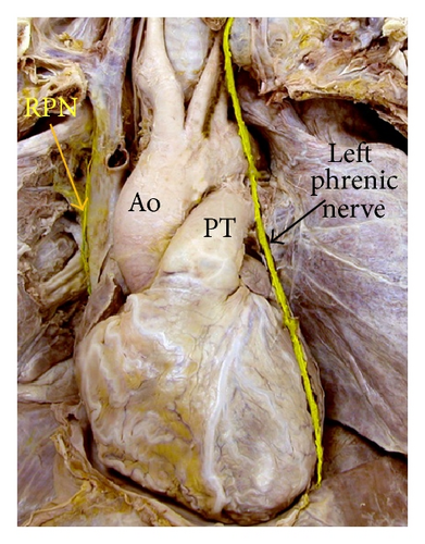 Details are in the caption following the image