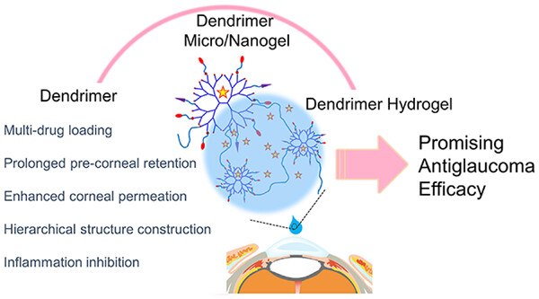 Dendrimer and dendrimer gel-derived drug delivery systems: Breaking bottlenecks of topical administration of glaucoma medications